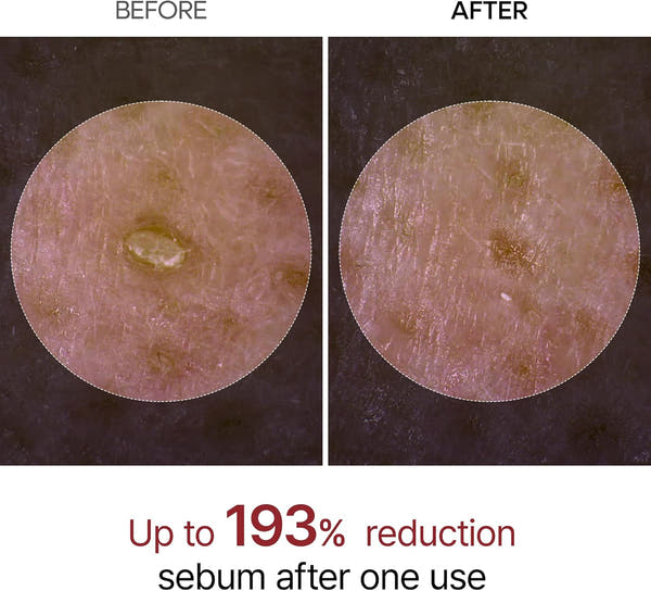 Dr. Melaxin White and Black Rice Peeling Ampoule, Soft Exfoliating Face and Body Scrub Dead Skin Cells Remover for All Skin Types