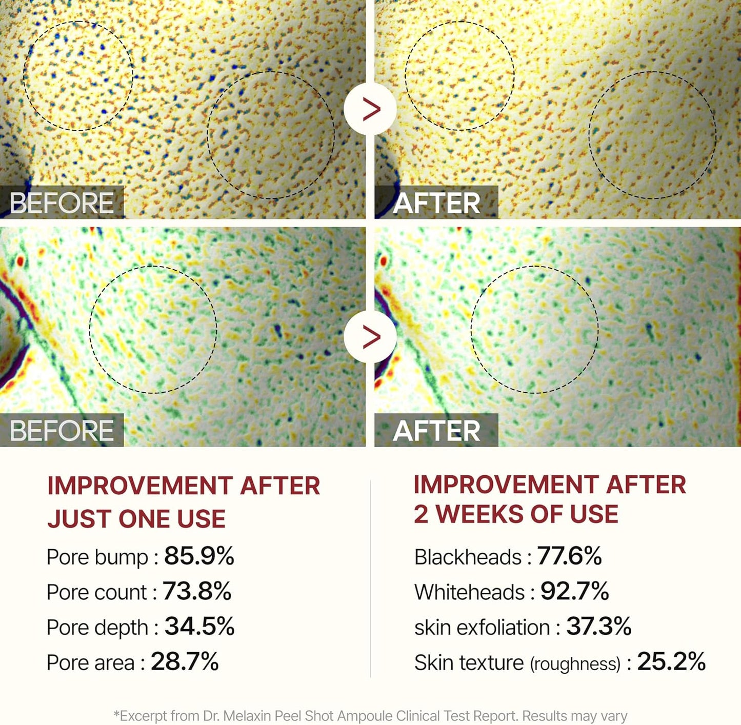 Dr. Melaxin White and Black Rice Peeling Ampoule, Soft Exfoliating Face and Body Scrub Dead Skin Cells Remover for All Skin Types