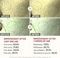 Dr. Melaxin White and Black Rice Peeling Ampoule, Soft Exfoliating Face and Body Scrub Dead Skin Cells Remover for All Skin Types